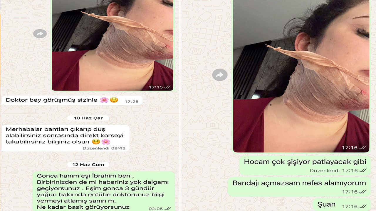 Ame1